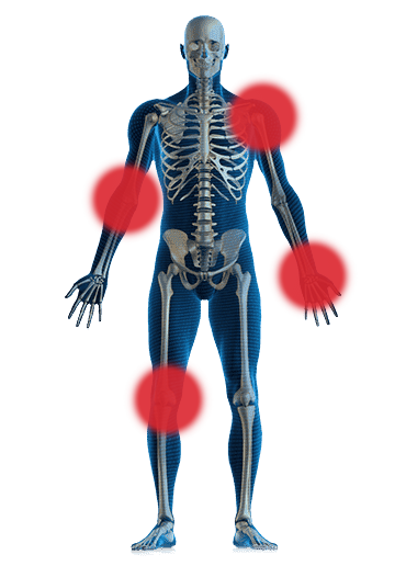 Esqueleto con áreas problemáticas